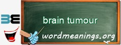 WordMeaning blackboard for brain tumour